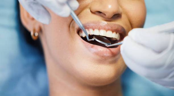 Best After-Hours Dental Care in Beale Af, CA