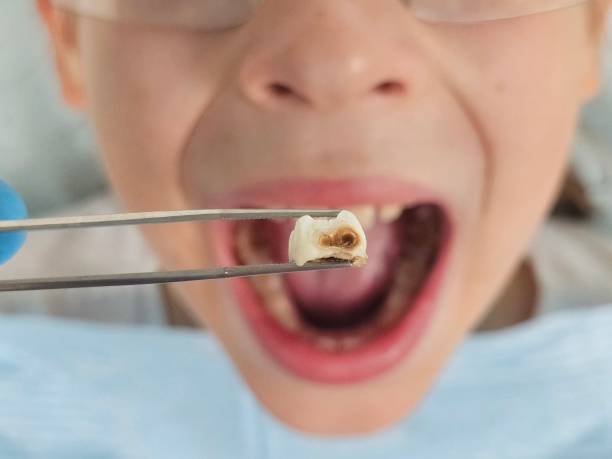 Best Emergency Orthodontic Repairs in Beale Af, CA